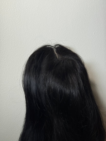 EXTENSIÓN PRÓTESIS FRONTAL
